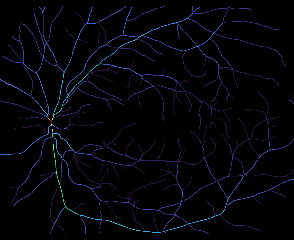 HRF retinal vessel output, colored by mean branch radius